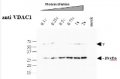 VDAC1-5 | Voltage-dependent anion-selective channel protein 1-5